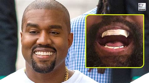 Kanye West Replaces His Teeth With Custom Made Titanium Dentures
