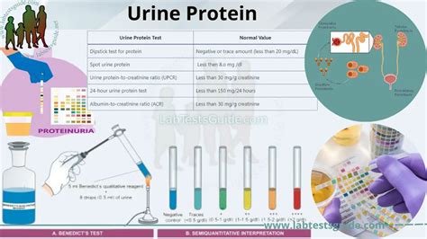 Risk Factors And Precautions For Protein In Urine Ask The Nurse Expert