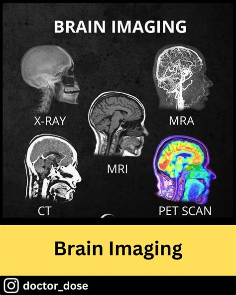 There Are Several Brain Imaging Techniques Ranatomy