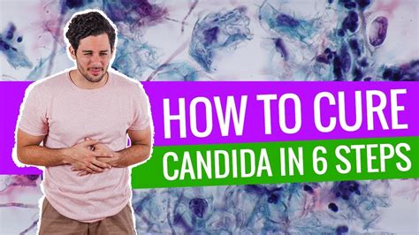 How To Cure Candida In 6 Steps Youtube