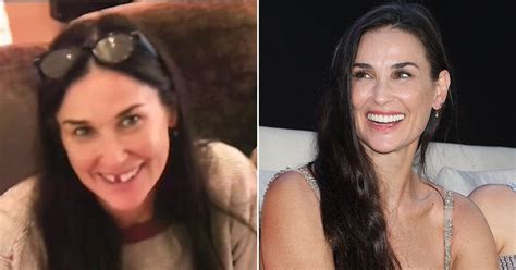 Demi Moore Loses Her Two Front Teeth To Stress Pictures Metro News