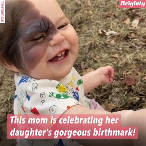 Parent On A Mission To Show Her Beautiful Daughter Who Has A Rare