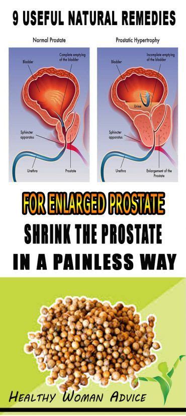 9 Useful Natural Remedies For Enlarged Prostate Shrink The Prostate In A Painless Way Enlarged