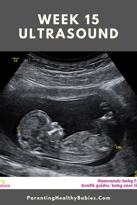 Pregnancy 15 Weeks Ultrasound Pregnancy Sympthom
