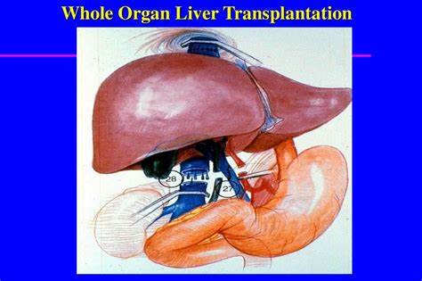 Острая печеночная и почечная недостаточность - online presentation Картинка - Острая печеночная и почечная недостаточность - online presentation