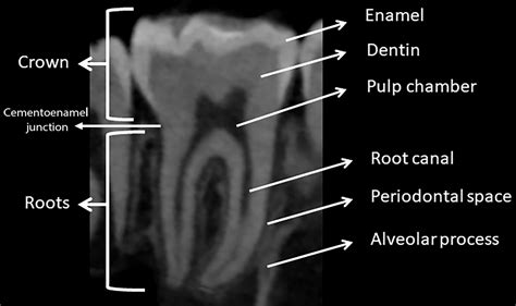 Dental Emergencies A Practical Guide Radiographics