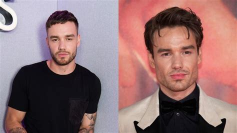 Did Liam Payne Get Plastic Surgery His Before And After Pic