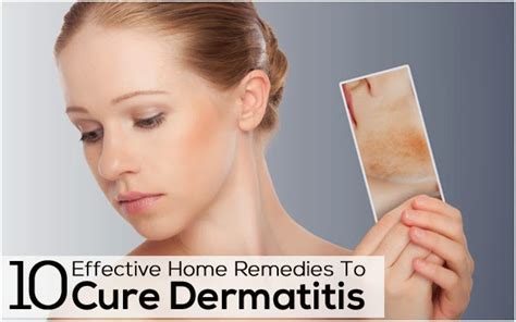 10 Effective Home Remedies To Cure Dermatitis Mzizi Mkavu