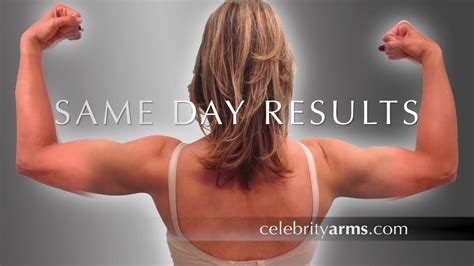 Celebrity Armsliposuction Lipo Arms High Definition Ultra