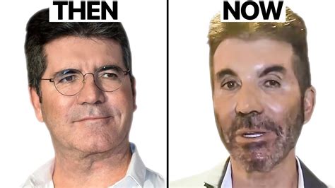 Simon Cowell New Face Plastic Surgery Analysis Youtube