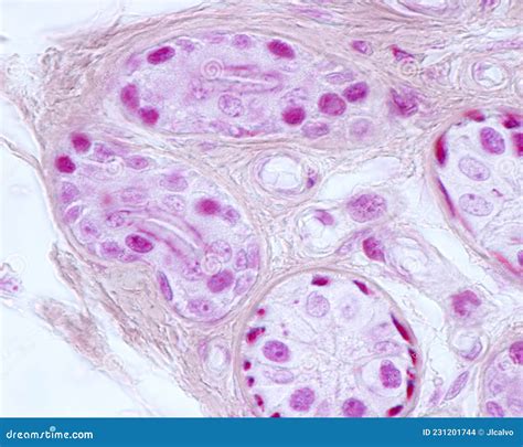 Eccrine Sweat Gland Myoepithelial Cells Stock Photo Image Of Mallory