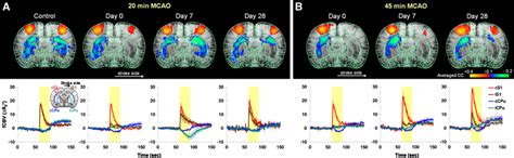 Cerebral Blood Volume Functional Magnetic Resonance Imaging Cbv Fmri