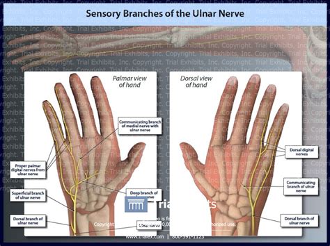 Sensory Branches Of The Ulnar Nerve Trialexhibits Inc