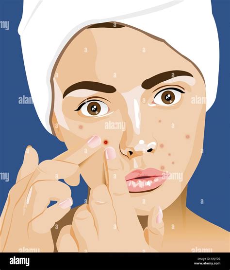 Girl With Pimples Acne Facial Cleansing Adolescence Skin Problems