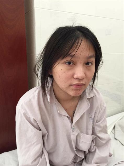 (hồ chí minh city) ipa(key): Kiều Anh Hera mặt sưng phù vừa tỉnh dậy sau 6 tiếng đại PTTM
