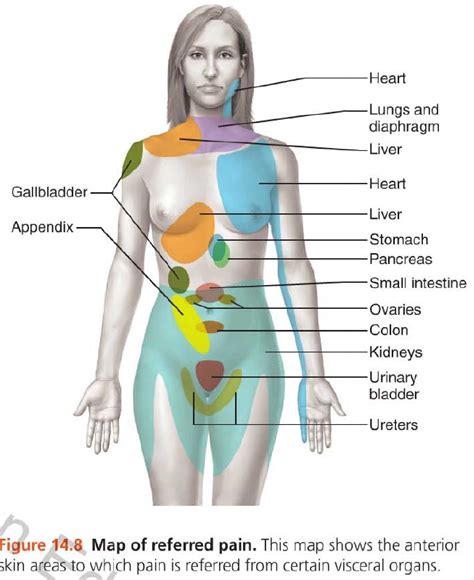 Referred Pain Chart My XXX Hot Girl