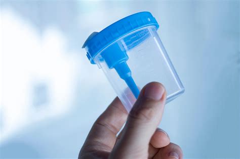 Simple Home Urine Test Could Revolutionize Diagnosis Of Prostate Cancer