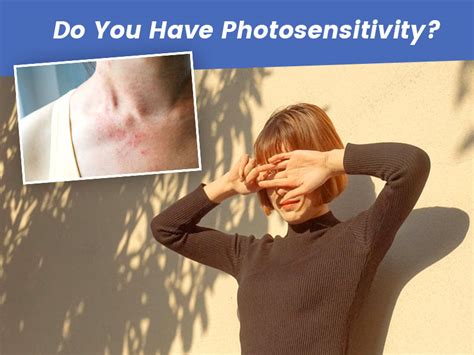 Photosensitivity Symptoms Causes Types Onlymyhealth