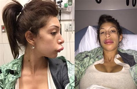 What Happened To Farrah Abrahams Lips Teen Mom Porn Star