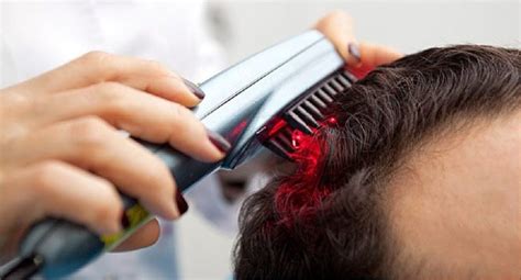 Early Signs Of Balding Causes Symptoms Tips And Treatment Options