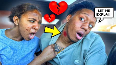 Hickey Prank On Girlfriend Extremely Wrong Youtube