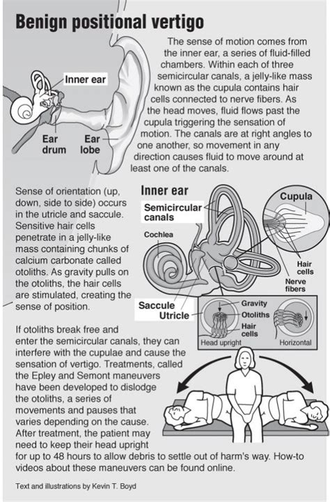 Vertigo Pointfinder Health Infographics