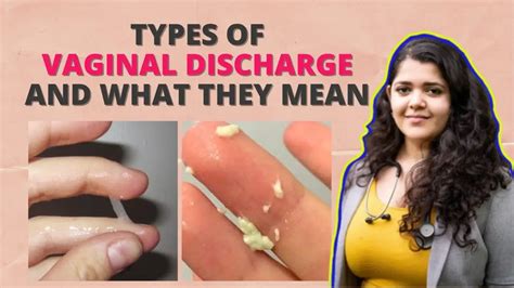 Types Of Vaginal Discharge Every Girl Should Know About