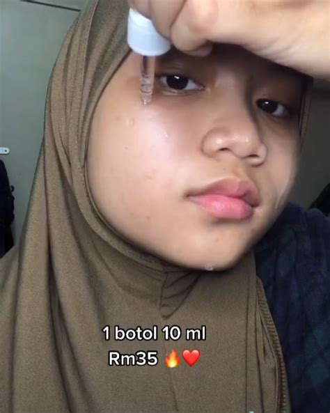 Senada, ketua presidium indonesia police watch (ipw) neta s pane menganggap aparat polisi sudah melanggar standar operasi dan. Selagi u tak cuba lagi pakai Serum... - mylaraskincarejb.wani