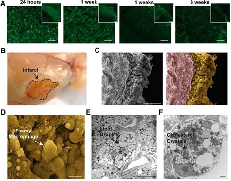 While apoptosis often provides beneficial effects to the organism, necrosis is almost always detrimental and can be fatal. eNeuro Blog