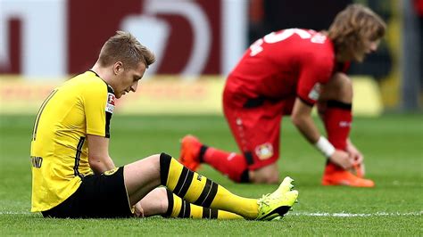 Reus To Miss Dortmunds Champions League Return With Suspected Muscle