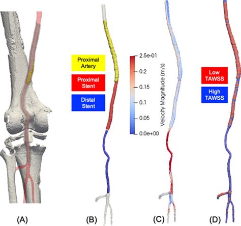 A Posterior View Of The Femoro Popliteal Artery In Straight Leg