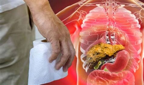 Fatty Liver Disease Two Colours In Your Urine That May Signal Late Stage Liver Disease