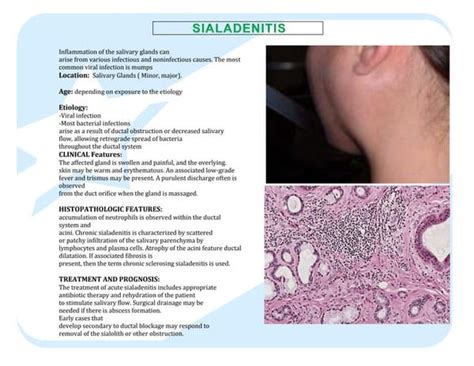 Differential Diagnosis Of Salivary Gland Lesions