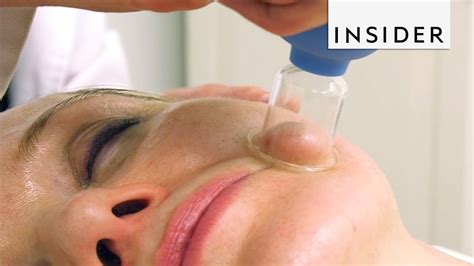 Face Cupping Gives Instant Facelift Youtube