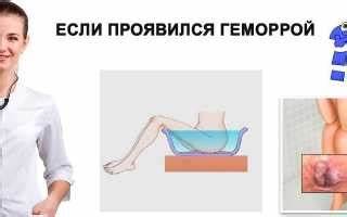 Вылез геморрой, что делать в первую очередь? Советы Картинка - Вылез геморрой, что делать в первую очередь? Советы