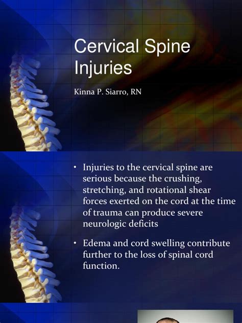 Cervical Spine Injuries Pdf Spinal Cord Injury Clinical Medicine