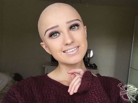 Stunning Alopecia Sufferer Who Is Confidently Displaying Her Bald Head Super Short Hair