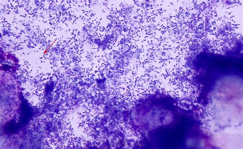 How To Read An Ear Cytology Veterinary