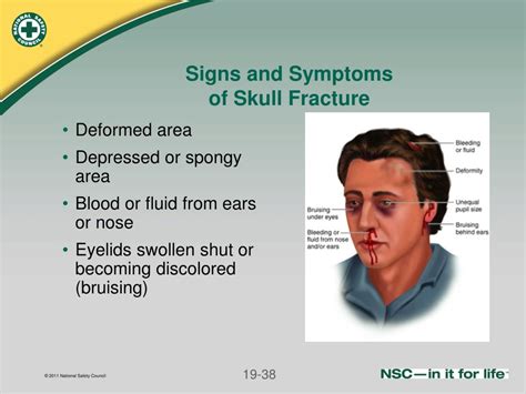 Ppt Injuries To The Head And Spine Powerpoint Presentation Free