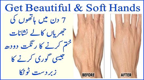 Walking outside in clothes that look as if they've been balled up, stuffed in a small envelope. How to Remove wrinkles from Hands | Get Instant Whitening ...