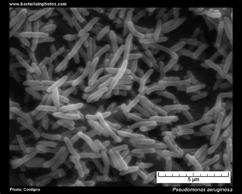 Scanning Electron Micrograph Sem Of Bacterial Biofilm Formed By