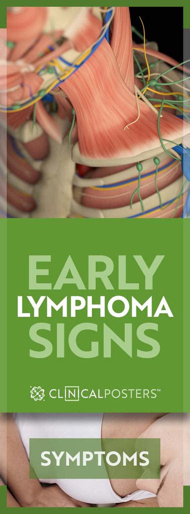 Early Warning Signs And Symptoms Of Lymphoma Clinicalposters
