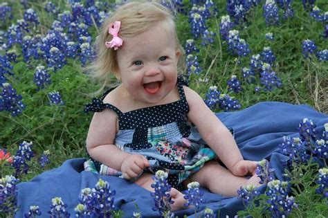 Hvad er tegn på downs syndrom? Beautiful baby girl with Down syndrome. ♥ (With images ...