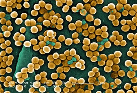 6 Facts You Should Know About Mrsa Clean Up Aftermath