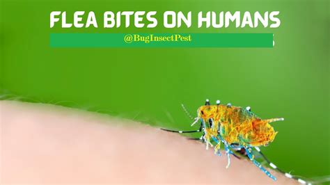 Get Rid Of Flea Bites On Humans Natural And Home Remedies Youtube