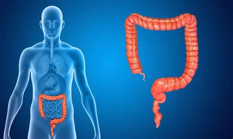 But how exactly are they used? The Difference Between Colon Cancer and Hemorrhoids