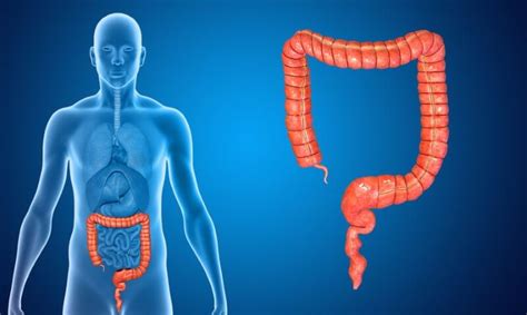 There's rarely a situation where either a semicolon or a colon. The Difference Between Colon Cancer and Hemorrhoids