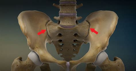 Sacroiliac Joint Pain Pontchartrain Orthodepics And Sports Medicine