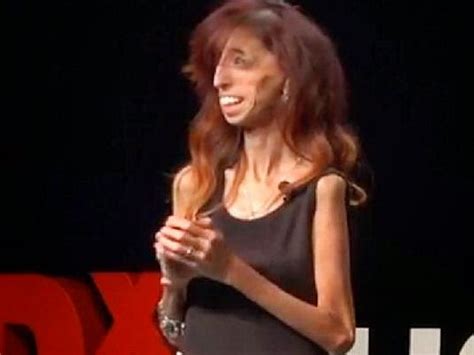 The Flying Tortoise Lizzie Velasquez Has Been Called The Worlds
