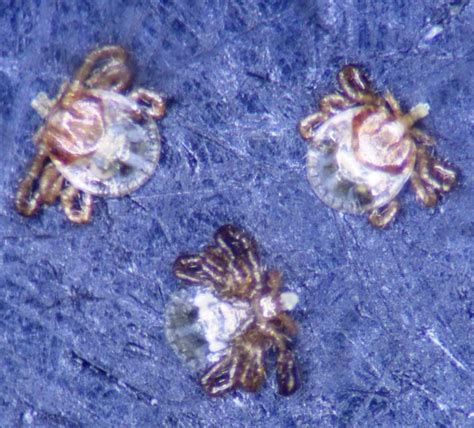 9 of 10 broncos are employed quickly, working in their field experience western michigan university. Ticks & Chiggers--a study | NJPB Forums